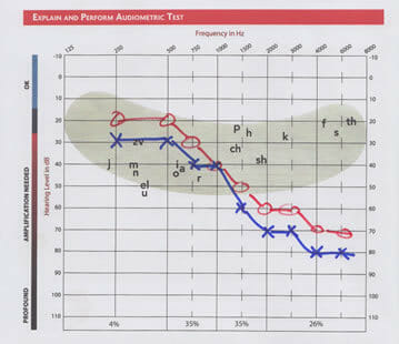 Audiogram: Audiogram: